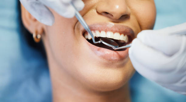 Best Emergency Tooth Extraction in Caledonia, MI